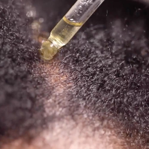 Atarah Hair Growth Oil video image